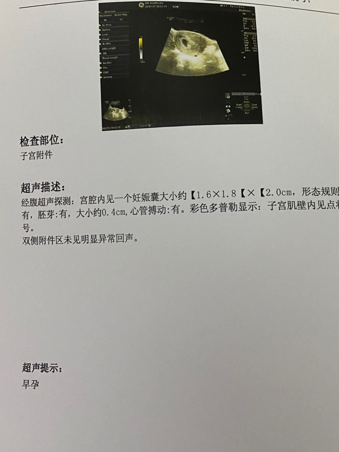 公司新闻 第520页